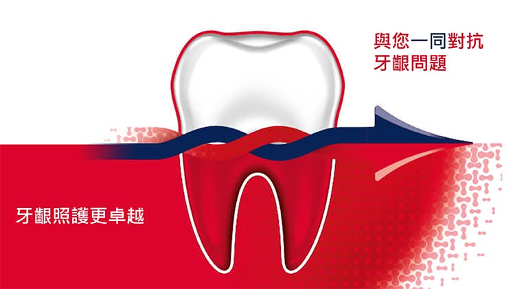 牙周適牙齦護理牙膏可以協助預防和處理牙齦流血以及牙齦炎。