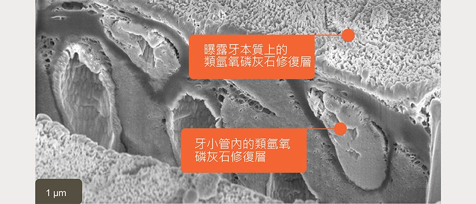 類氫氧磷灰石修復層 SEM 影像