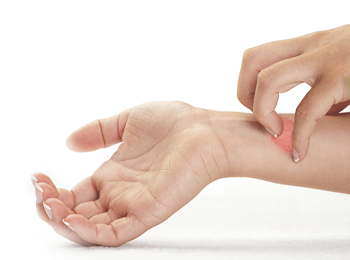 Unterarm kratzende Hand Unterarm kratzende Hand