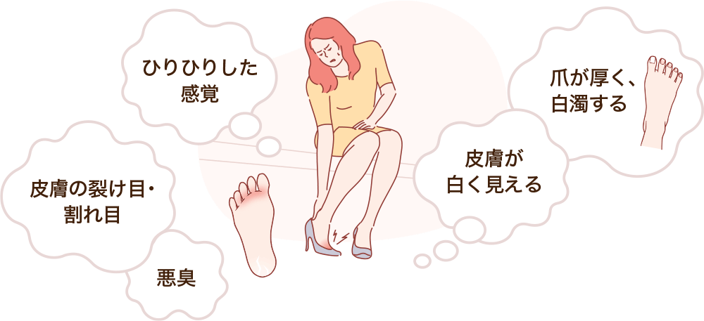 "かゆい"だけじゃない!多様な水虫の症状 "かゆい"だけじゃない!多様な水虫の症状
