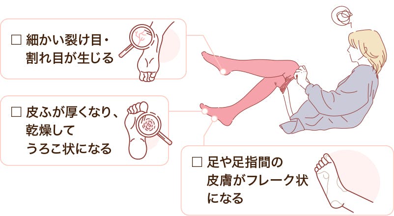 Case2: かかとが乾燥して、ストッキングに引っかかる? Case2: かかとが乾燥して、ストッキングに引っかかる?