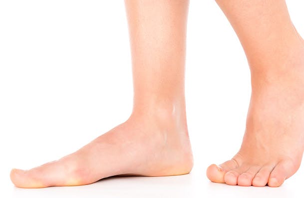 무좀은 무엇인가요? 무좀 설명과 사람의 발 - 라미실