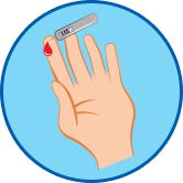 Diabetes or narrowed blood vessels Diabetes or narrowed blood vessels