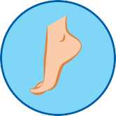 甚麼是腳部真菌感染? 成因是什麼?