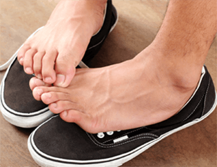 foot-fungul foot-fungul