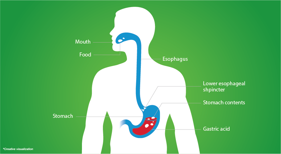 Diagram to describe Acidity 