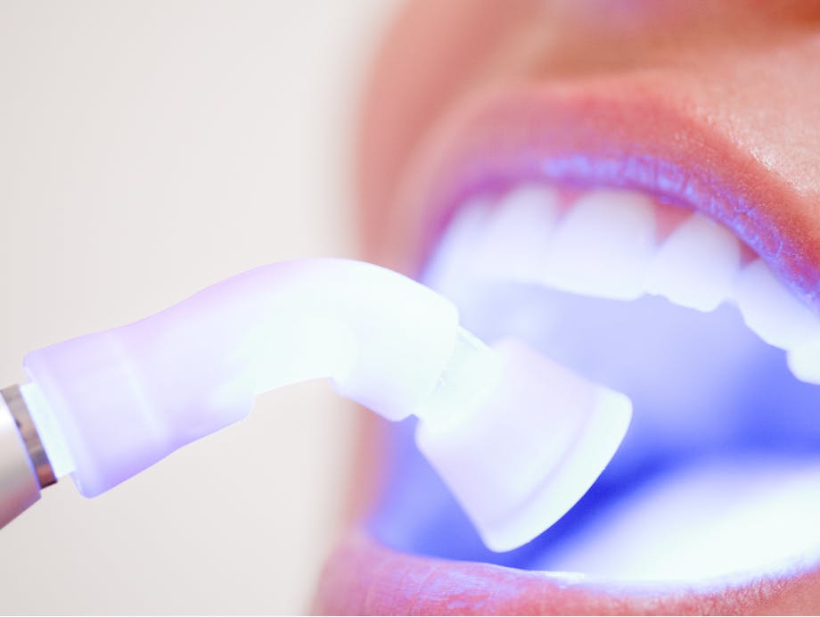 Whitening Sensitive Teeth