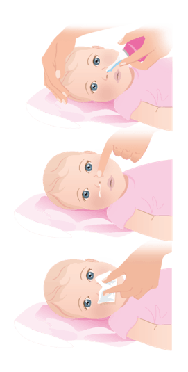 Méthode Prorhinel comment moucher votre bébé 