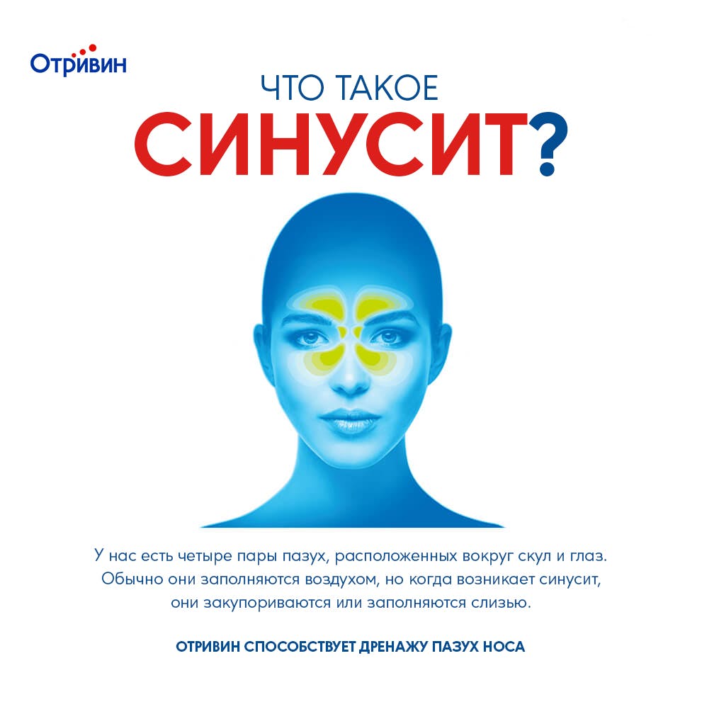 Что такое синусит?