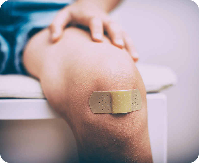 Grazes and Bruises in Children Grazes and Bruises in Children