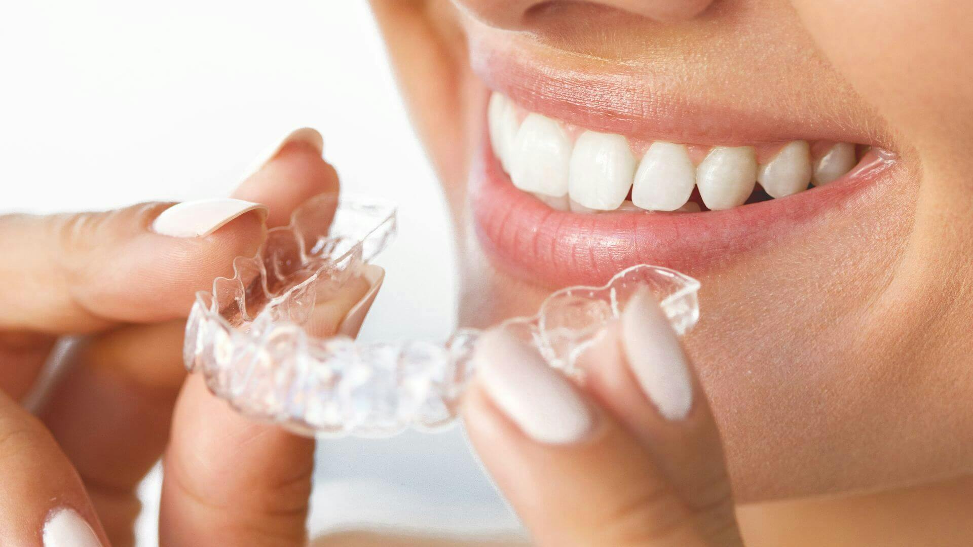 Woman putting retainer in her mouth
