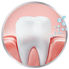 repair-maintain-gingival