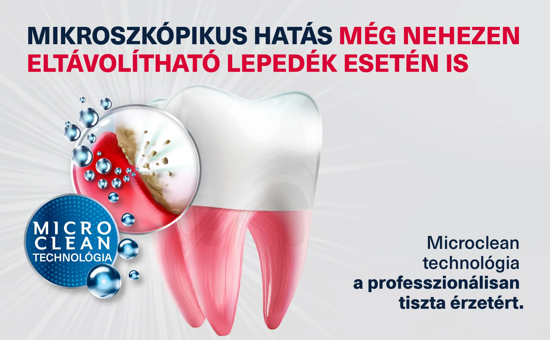Fogat és ínyt ábrázoló illusztráció nagyított részlettel, amely a lepedék eltávolítását mutatja. A banner a Microclean technológiát és a professzionálisan tiszta érzetet emeli ki.