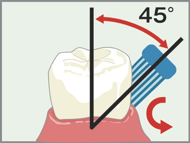 歯周病対策に有効な歯の磨き方のポイント