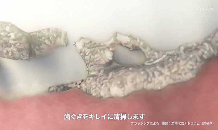 歯と歯ぐきを綺麗にする