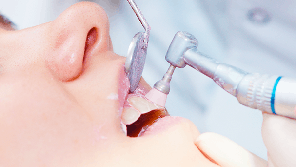 A woman's teeth being cleaned at the dentist. 
