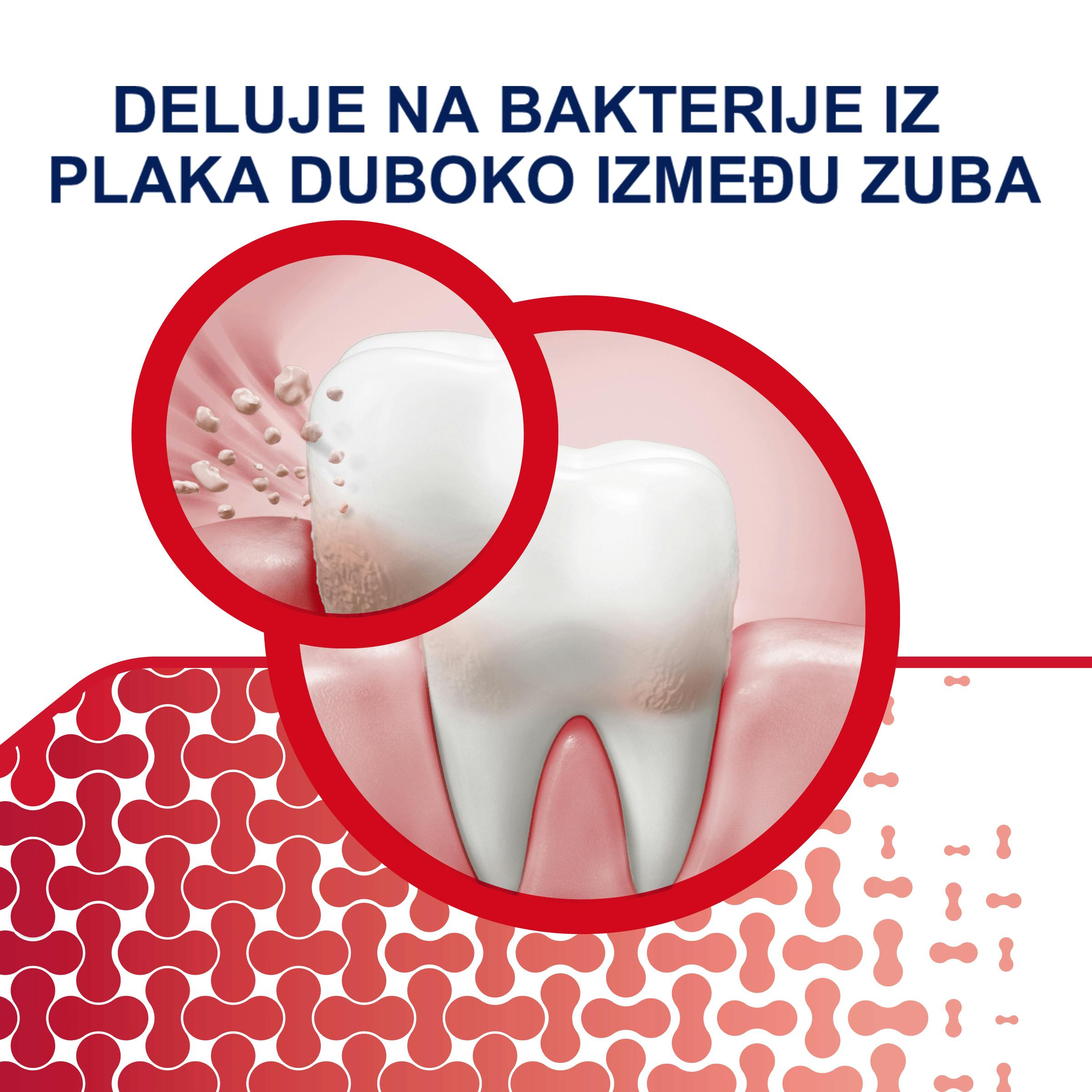 DELUJE NA BAKTERIJE IZ PLAKA DUBOKO IZMEĐU ZUBA