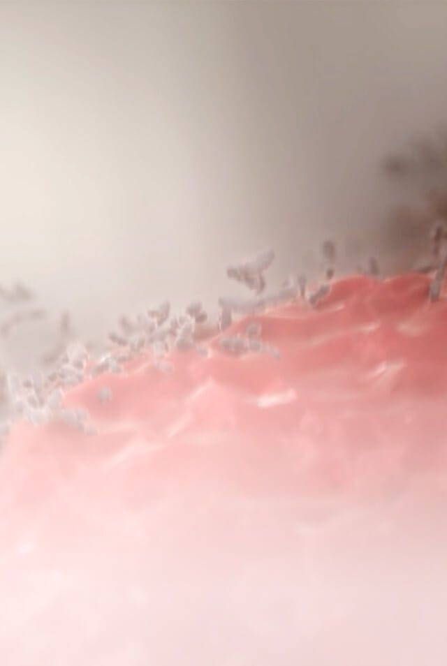 "Illustration of bacteria on the gums, with the label 'Causes'"