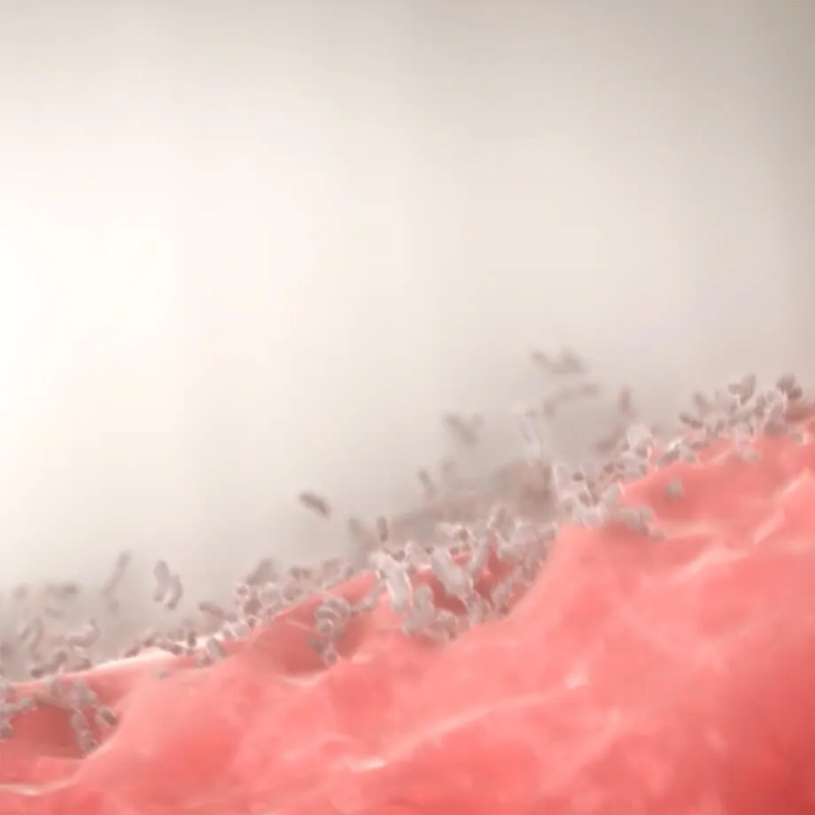 Illustration of bacteria on the gums