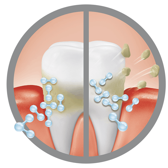 Bild erklärt wie eine Infografik anhand von drei Zähnen wie gesünderes Zahnfleisch entsteht 