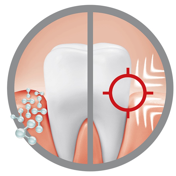 Bild erklärt wie eine Infografik anhand von drei Zähnen wie gesünderes Zahnfleisch entsteht 