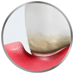 receding gums icon