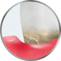 swollen gums icon