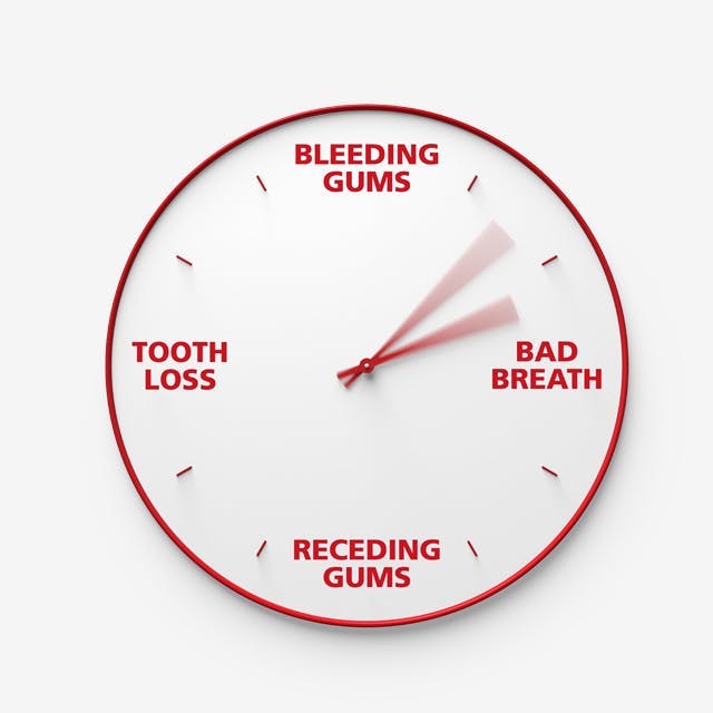 gum disease clock