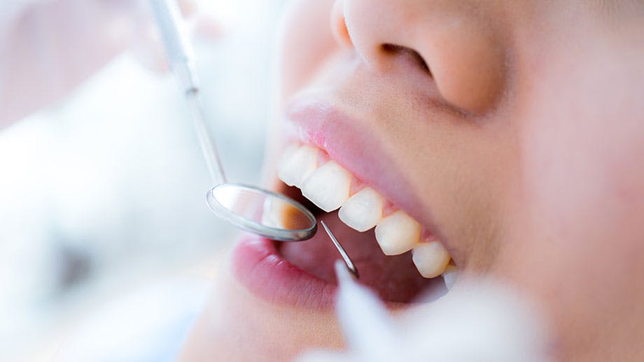 Close up of woman getting teeth cleaned