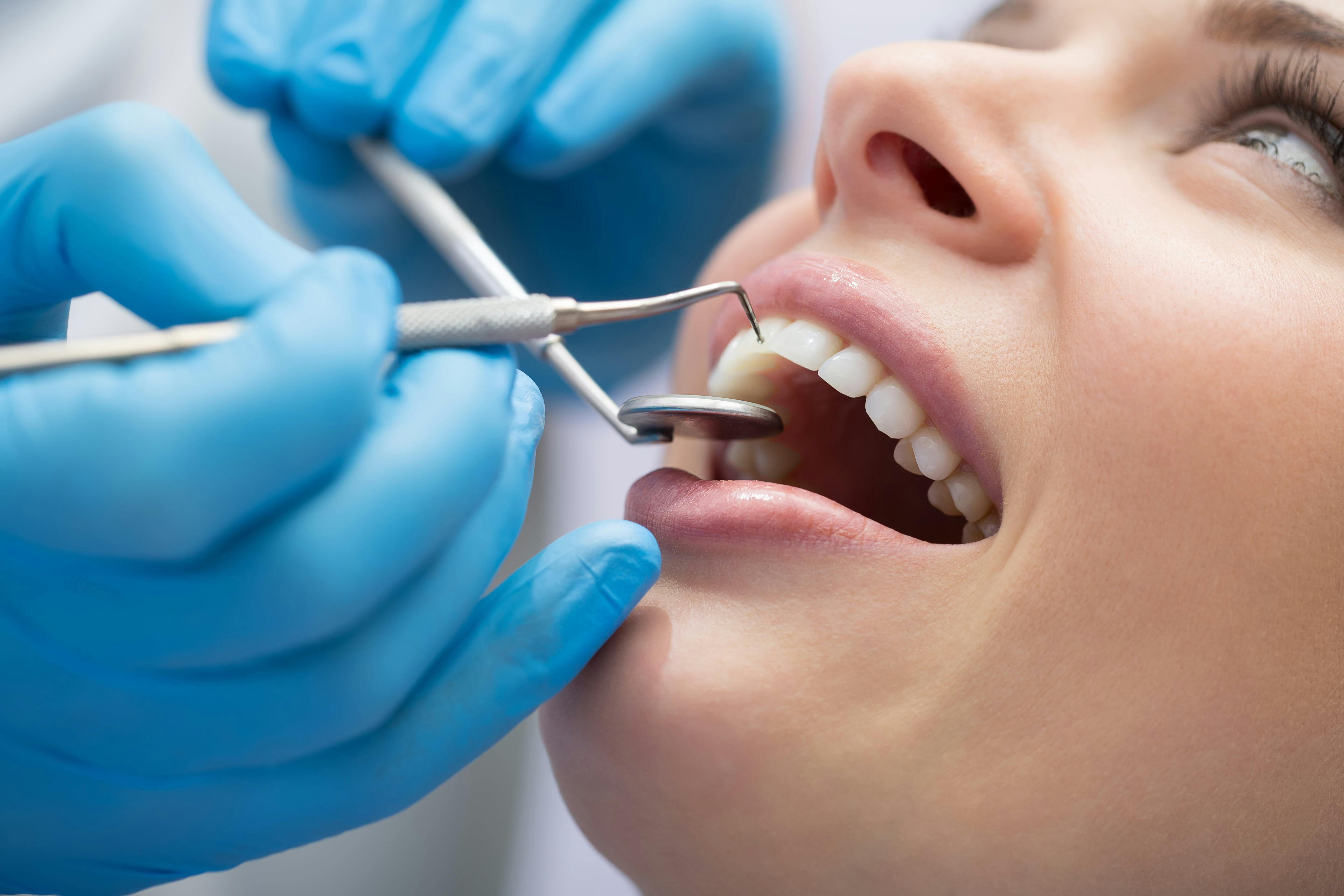 Woman getting teeth cleaned at dentist