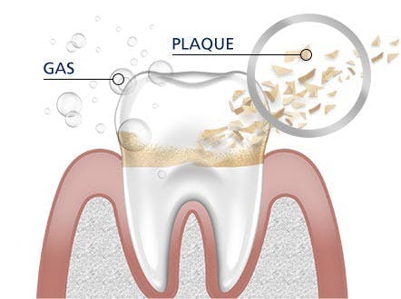 Teeth Cleaning parodontax