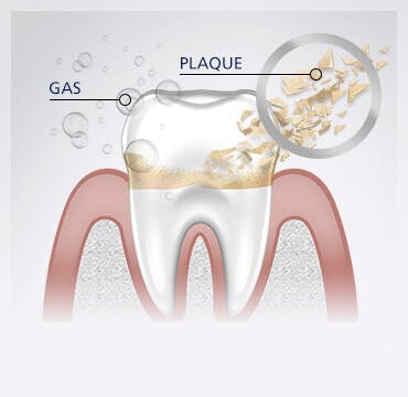 Keep Your Gums Healthy and Teeth Strong