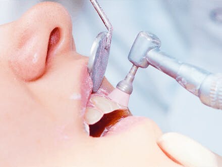 Kvinnlig patient får sina tänder polerade av tandläkare