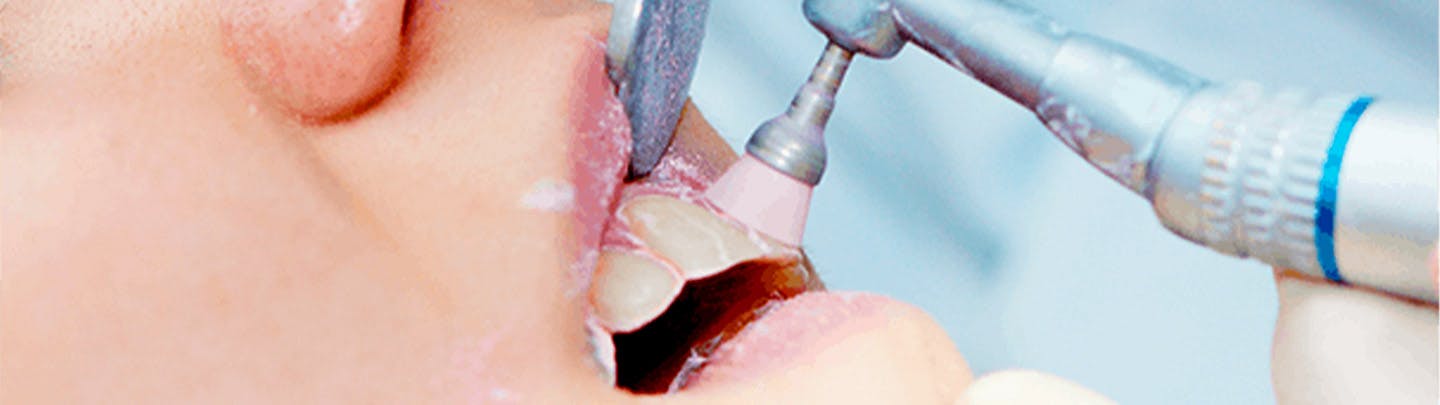 diş tedavisi uygulamaları