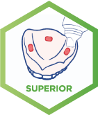 adhesivo para prótesis dental - prótesis dental superior