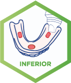próteis dental inferior - cómo usar el adhesivo dental