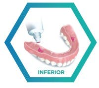 Aprende a usar correctamente el pegamento dental para prótesis