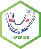 Inferior