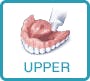 upper dentures