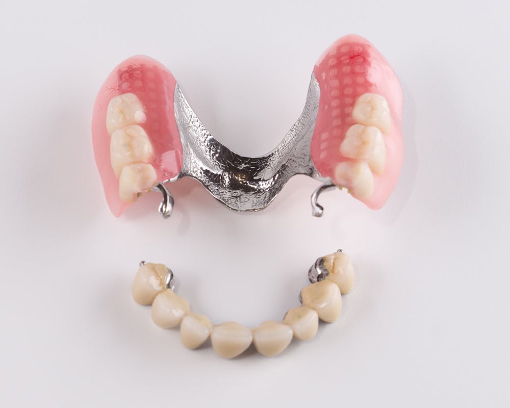 what-are-complete-dentures what-are-complete-dentures