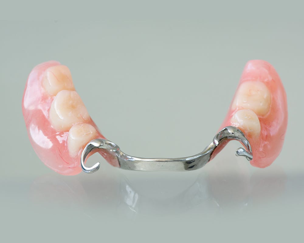 what-are-complete-dentures what-are-complete-dentures