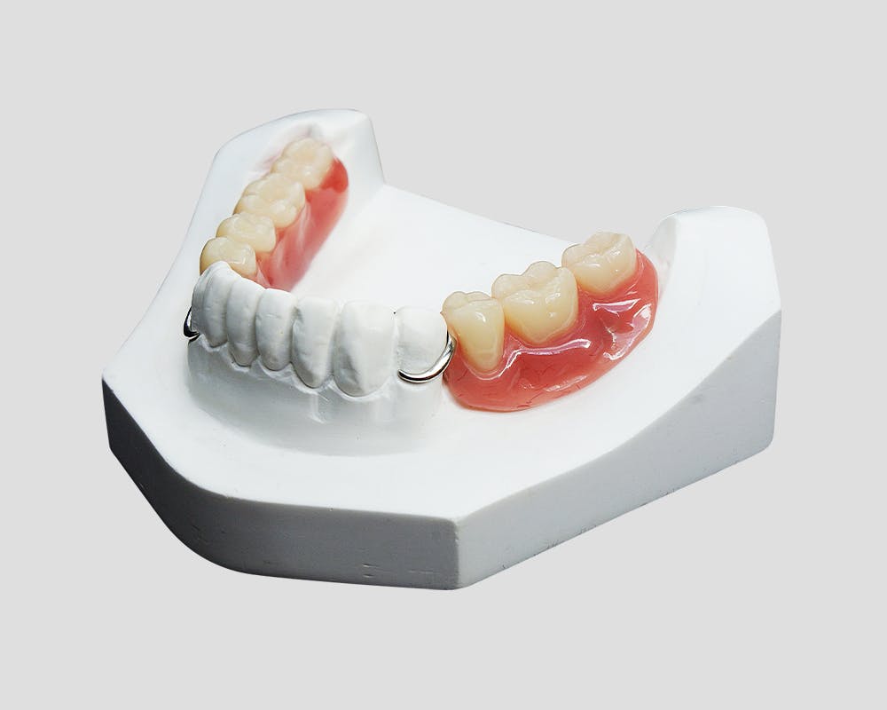 what-are-complete-dentures what-are-complete-dentures