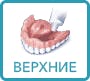 як застосовувати крем для фіксації на верхній частині протезу