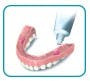 如何將假牙固定劑塗抹在假牙下部
