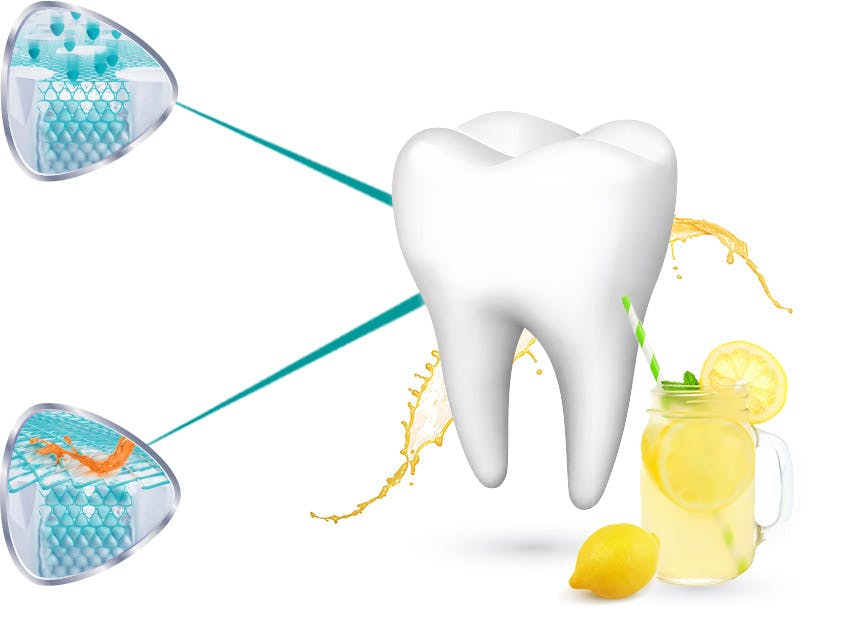 Illustration of a tooth’s enamel being reinforced and protected from acid attacks