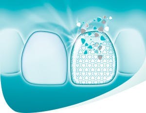 Strengthening tooth enamel