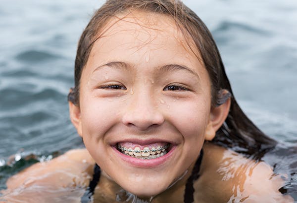 Girl With Braces Swimming