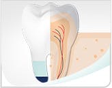 L'émail des dents est composé de 95 % de minéraux, de 4 % d'eau et de 1 % de protéines 