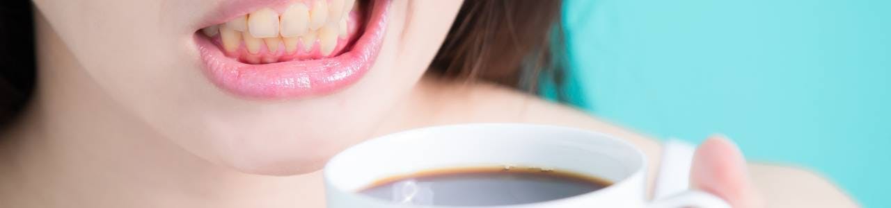 A woman who has yellow teeth from drinking coffee.
