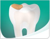 Tooth With Cavity Mobile
